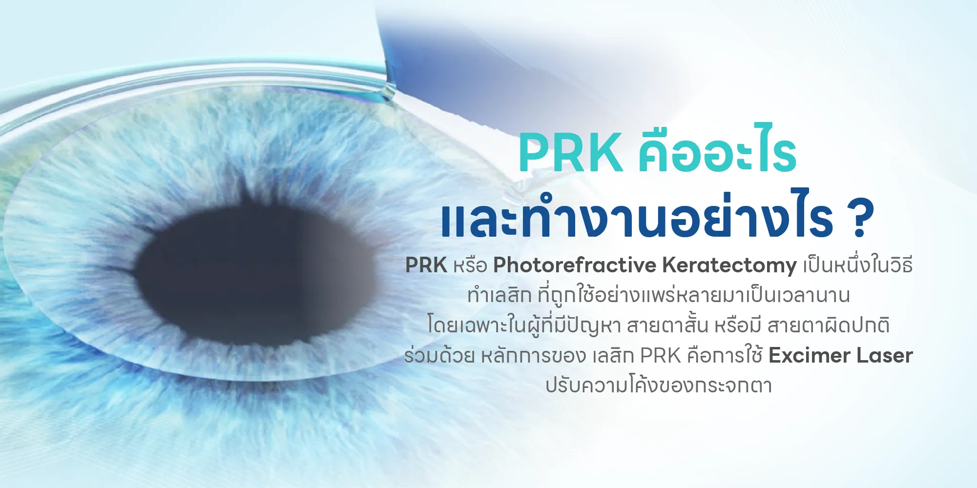 PRK คืออะไร และทำงานอย่างไร